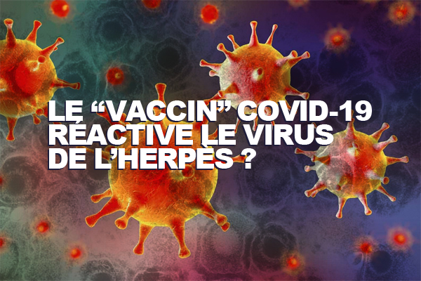 Virus de l'Herpès réactivé après injection Covid-19