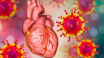 Décès par Myocardite- Vaccin Covid