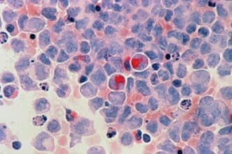 L'intelligence artificielle révolutionne le diagnostic du cancer avec une précision inédite : découvrez comment cette technologie sauve déjà des vies.