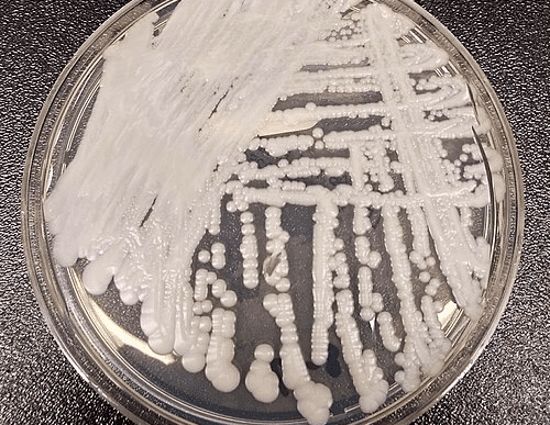 Un champignon multirésistant se propage rapidement en Europe, selon l'ECDC